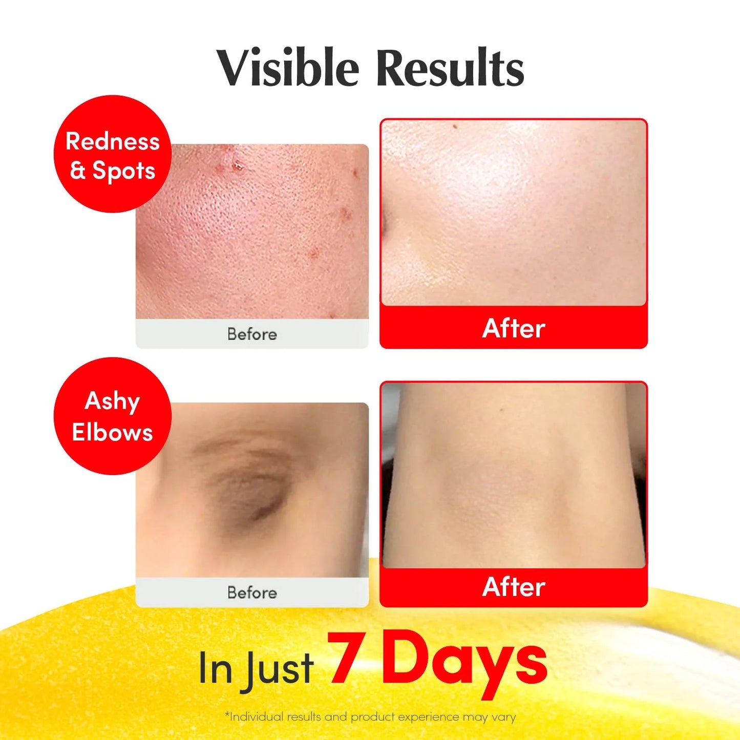 EQQUALBERRY - Vitamin Illuminating Serum