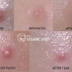 Cosrx acne pimple master patch 💙