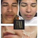 peeling zena aux algues