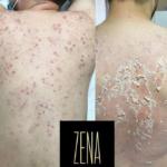 peeling zena aux algues